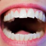 Dzisiejsza technika używana w salonach stomatologii estetycznej może sprawić, że odzyskamy śliczny uśmiech.